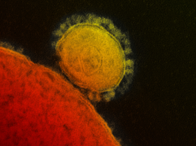 MERS coronavirus