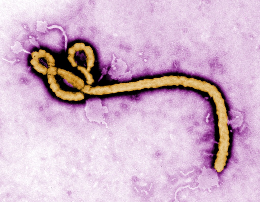 ebola 