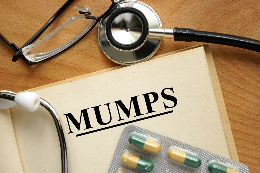 Mumps